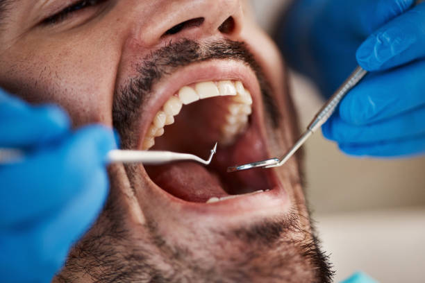 Best Emergency Gum Pain Relief  in Myrtletown, CA