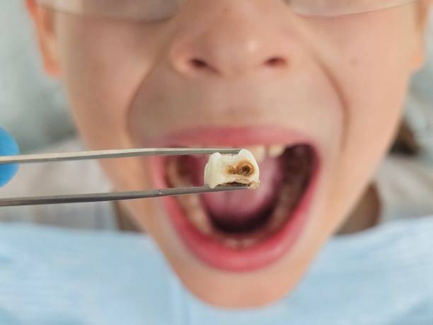 Best Teeth Whitening  in Myrtletown, CA